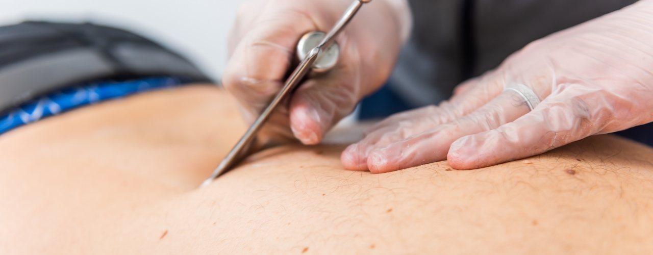 graston-technique-hands-of-hope-physical-therapy-Manhattan-NY