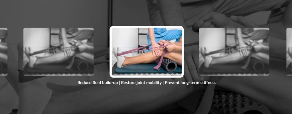 Post-Surgical Swelling Management with Physical Therapy